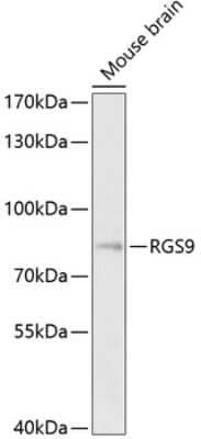 Western Blot: RGS9 Antibody [NBP2-93231] - Western blot analysis of extracts of mouse brain, using RGS9 antibody (NBP2-93231) at 1:1000 dilution. Secondary antibody: HRP Goat Anti-Rabbit IgG (H+L) at 1:10000 dilution. Lysates/proteins: 25ug per lane. Blocking buffer: 3% nonfat dry milk in TBST. Detection: ECL Basic Kit. Exposure time: 5s.